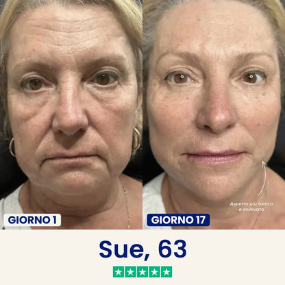 Verilia Lift - Maschera lifting doppio mento