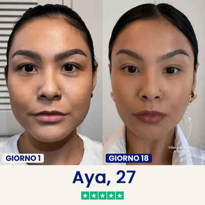 Verilia Lift - Maschera lifting doppio mento