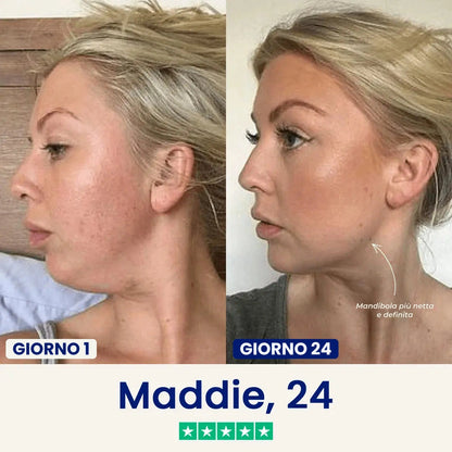 Verilia Lift - Maschera lifting doppio mento